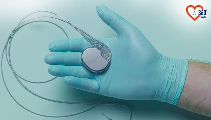 Pacemaker Surgery Cost