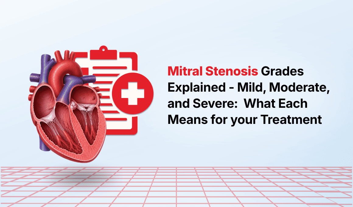 Mitral Stenosis Treatment in Chennai