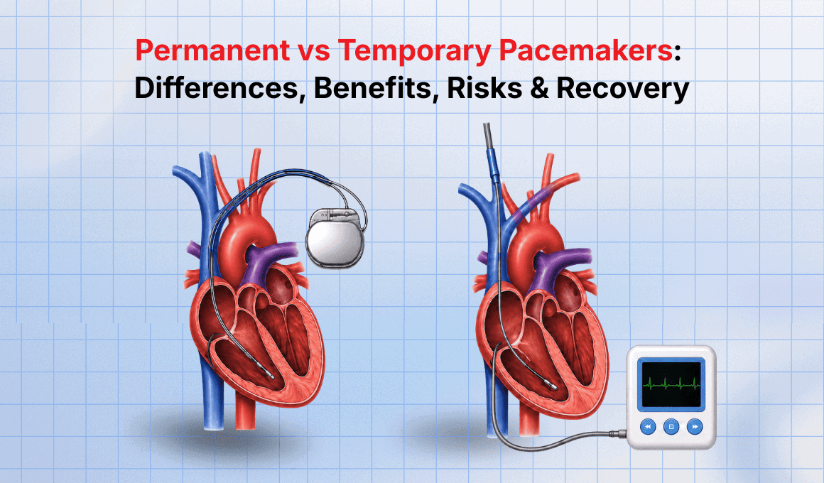 Permanent vs Temporary Pacemaker