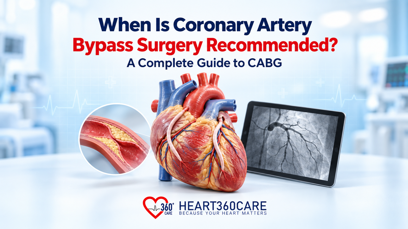 coronary artery bypass surgery